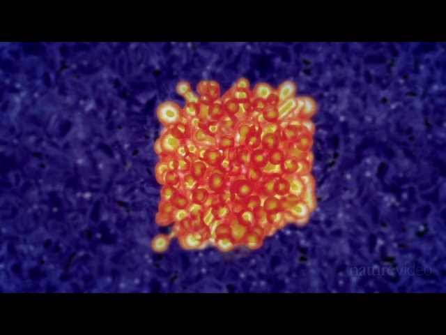 Immunotherapy: Boosting the immune system to fight cancer