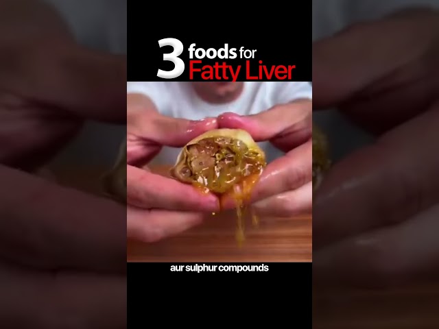Best Foods for Fatty Liver | Improve Liver Health tips, Doctor Explains #fattyliver #liverhealth
