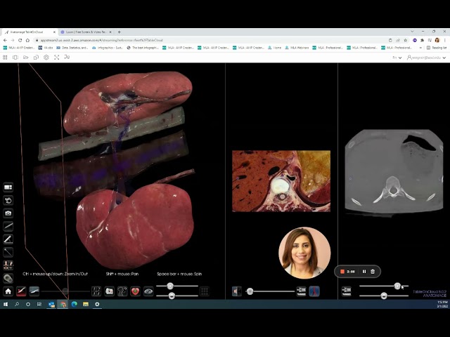 Anatomage: High Resolution Kidney- Version 8
