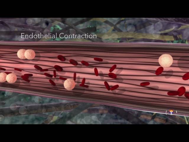 Acute Inflammation- Educational 3D Animation