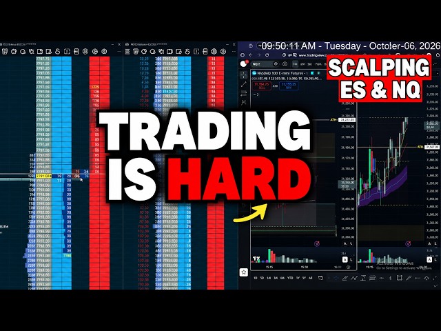 Without The DOM This Trade is a 100% Loser