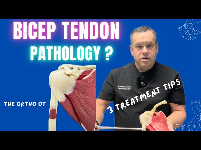 ✅ Long Head Bicep Tendon Inflammation Tips