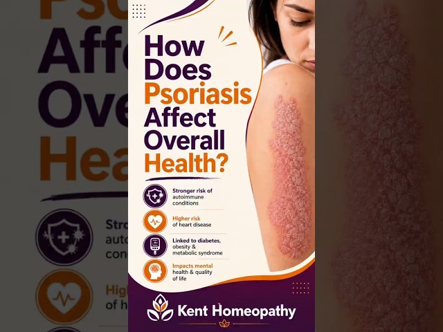 How Does Psoriasis Affect Overall Health? \ Dr kukreja A Kalani \ kent homeopathy Mumbai