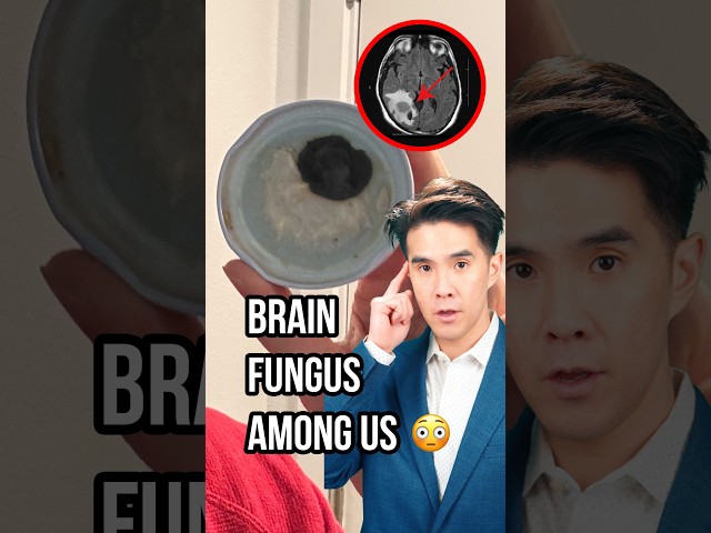 Insane Brain 🧠 Fungus Report In USA 🍄