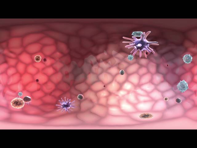 Evolution MOA Sample 1: 360 VR Medical Experiences