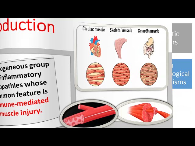 Idiopathic inflammatory myopathies ( part 1)