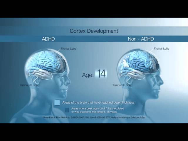 King's College London: Neurobiology Animation