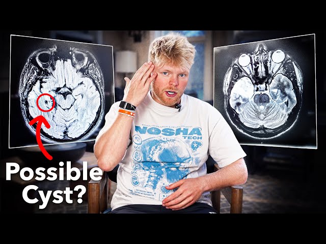 the final brain tumor update…