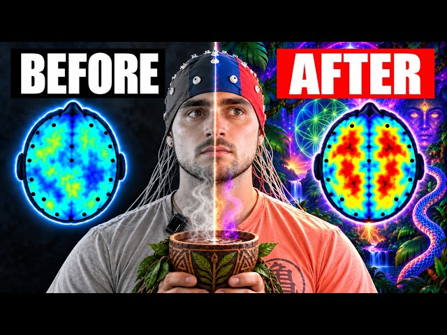 They Scanned My Brain Before & After Ayahuasca (DMT Documentary)