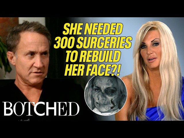 Sarah Spent $3 MILLION on 300 Surgeries to Repair Her Destroyed Face?! | Rejected By Botched | E!