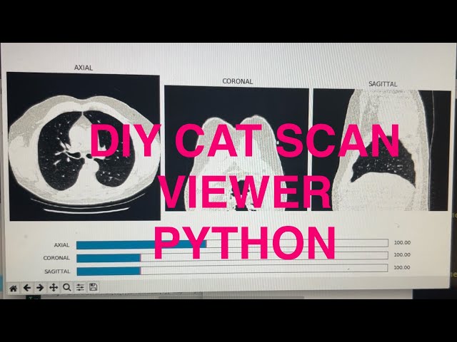 Create your own Medical Image Viewer using Python and Pydicom