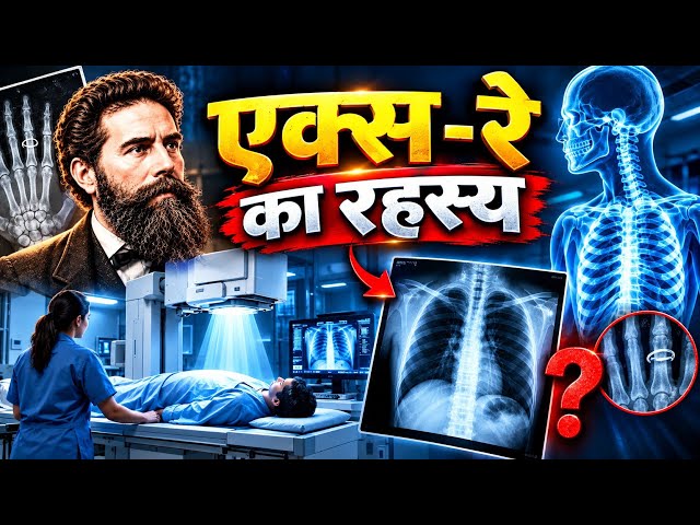 How Modern X-Ray Works: Complete History and Invention Documentary