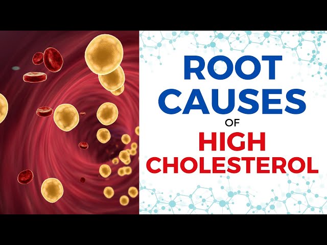 Discover the Root Causes of High Cholesterol with Functional Medicine