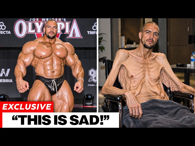 12 Bodybuilders Who Became Unrecognizable After Quitting