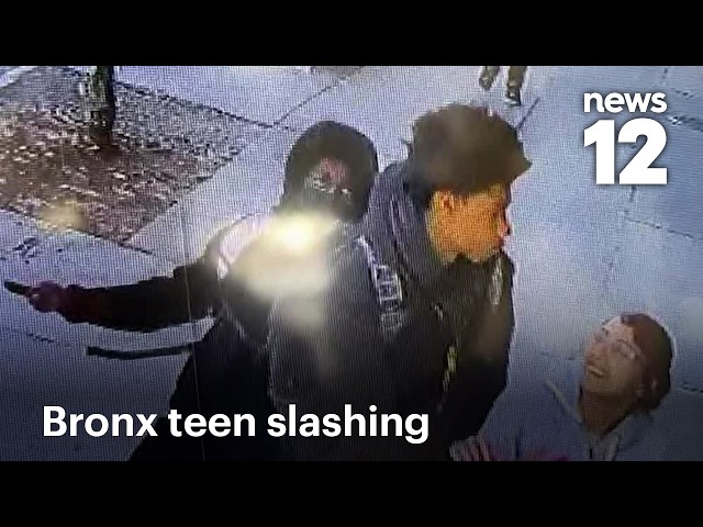 EXCLUSIVE: Teen slashed in neck in The Bronx; suspects still on the run