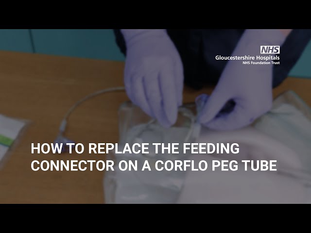 How to replace the feeding connector on a Corflo PEG Tube
