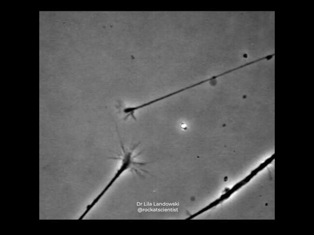 FINDING THAT CONNECTION © - Neurons connecting in a petri dish - growth cones sensing one another