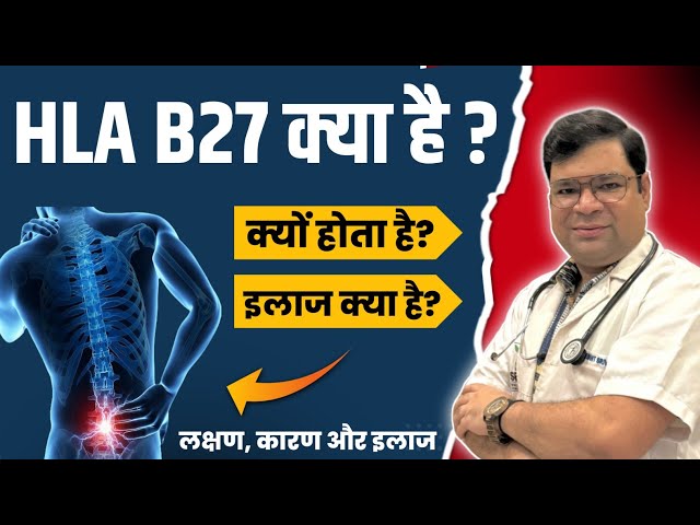 HLA B27 Positive क्या है ? | HLA B27 Test in hindi | What is HLA B27 | #youtubeshortshlab27 