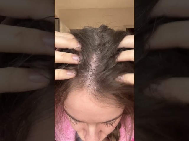 Ultimate Hair Care Routine for a Clean and Refreshed Look #hair #how #beautiful #shorts #amazing