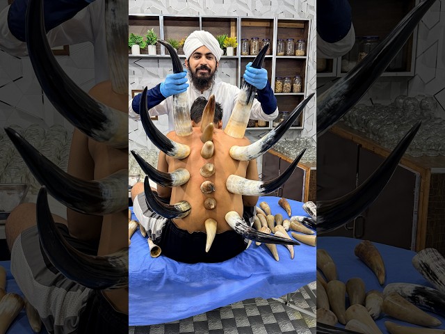 Horn Cupping for Upper Back, Shoulder & Lower Back Pain | Traditional Therapy & Healing | Dr Usman