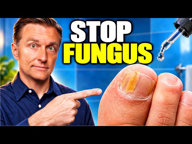 Why Toenail Fungus Keeps Coming Back (The $2 Cure That Actually Works)