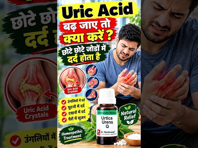 Uric Acid बढ़े तो क्या करें | Uric Acid Treatment | Uric Acid Control Tips #shorts #healthtips