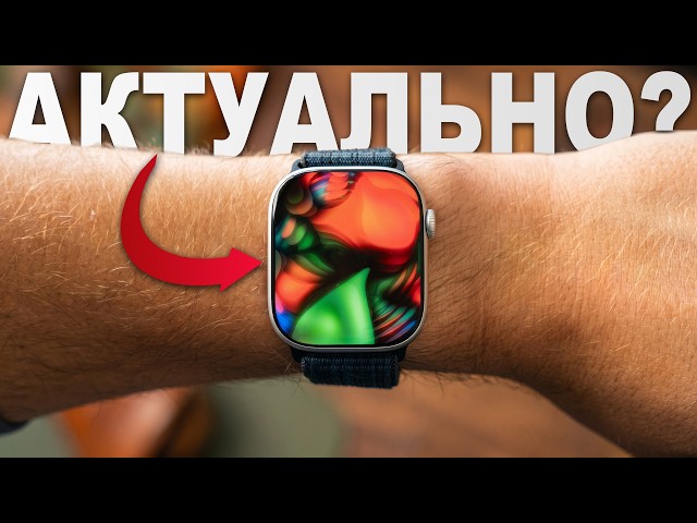 This is why you need an Apple Watch