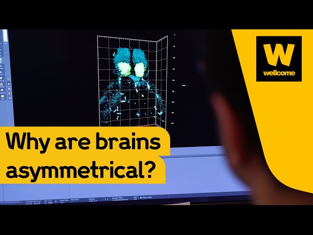 Why the left brain and right brain are so different | Wellcome