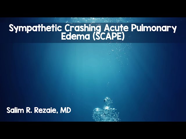Sympathetic Crashing Acute Pulmonary Edema