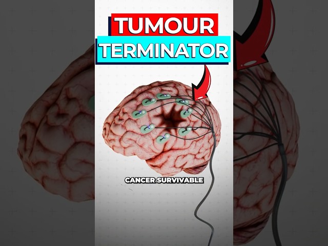 Scientists Create Implant To Cure Brain Cancer