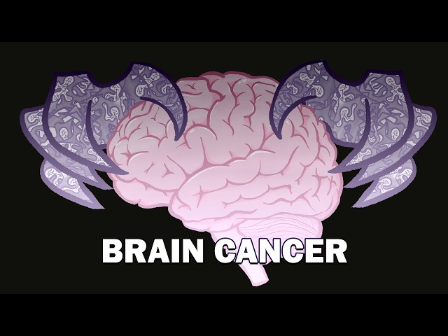 The Cancer That Rewires Your Neurons