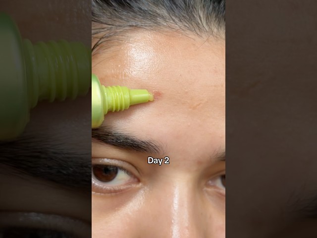 Arencia vitamin C booster shot ✅✨#arencia #acne #vitamincboostershot#darkspots #skincare