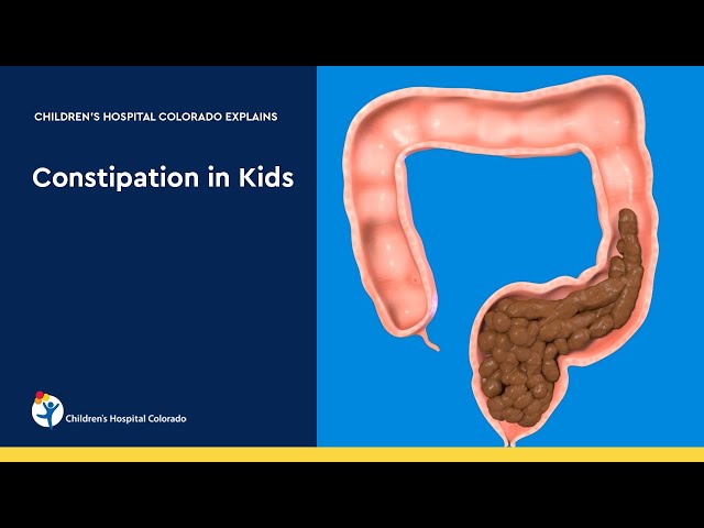 Pediatric Laxatives: Senna vs PEG