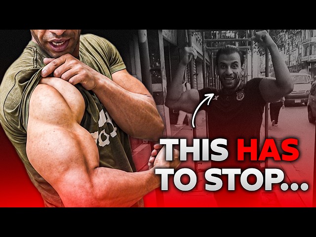 This Guy's Arms Are Horrifying...