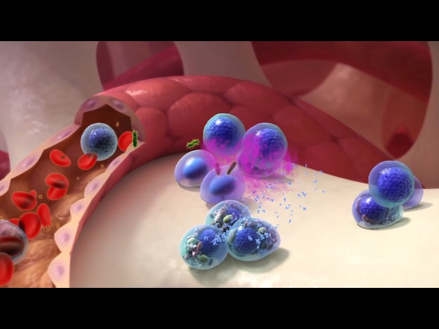 The Link Between Inflammation and Heart Disease | Preventive Cardiology