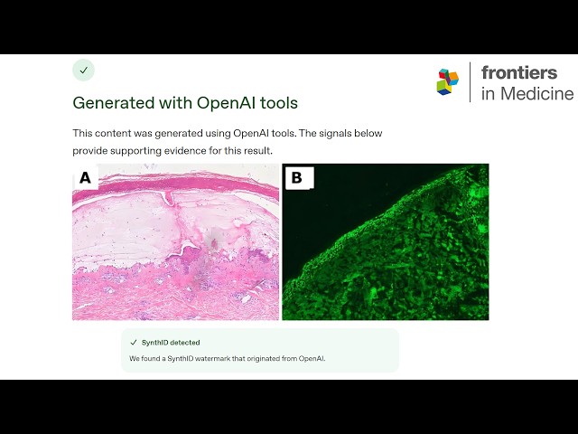 ChatGPT's Hidden Watermark Exposes AI Generated Case Report