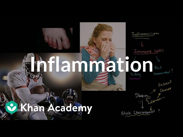 Inflammation | Miscellaneous | Heatlh & Medicine | Khan Academy