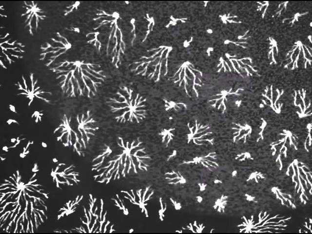 Pattern formation in slime mold Dictyostelium