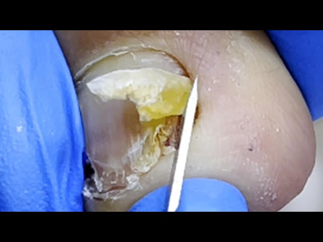 Pedicure Tutorial：Manicure for ladies【Pedicure Master Lin Jun】
