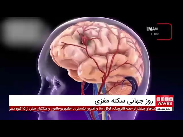 World Stroke Day