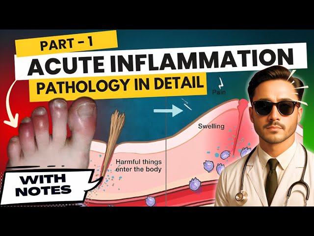 Acute inflammation pathology | differences between acute and chronic inflammation general pathology
