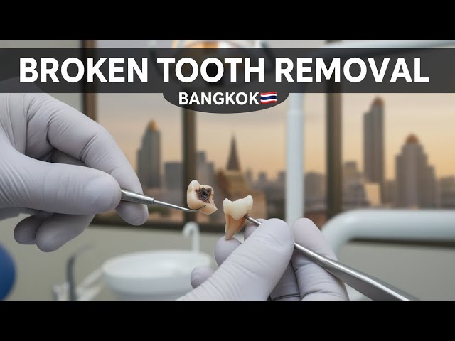 Broken Tooth Removal Bangkok