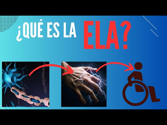 What is Amyotrophic Lateral Sclerosis?