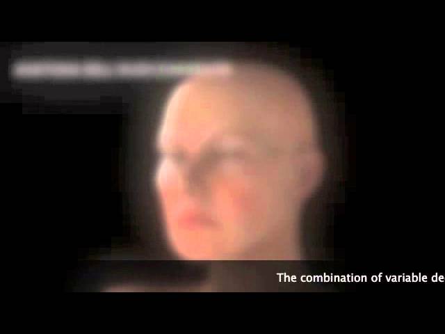 FACIAL AGING PROCESS