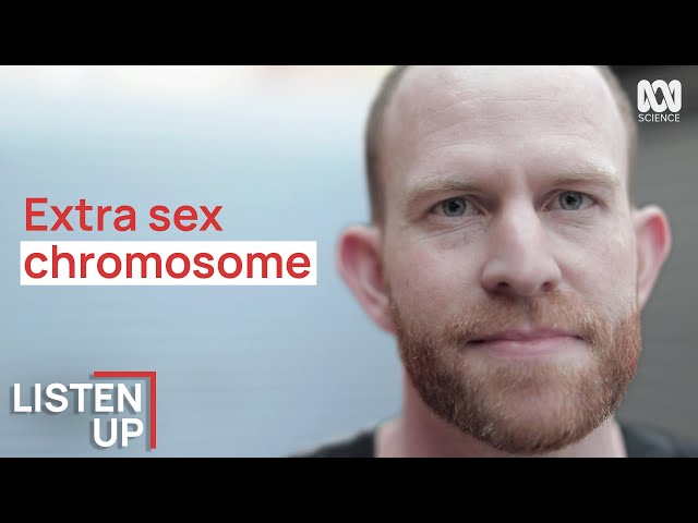 “I Was Born With An Extra Chromosome”