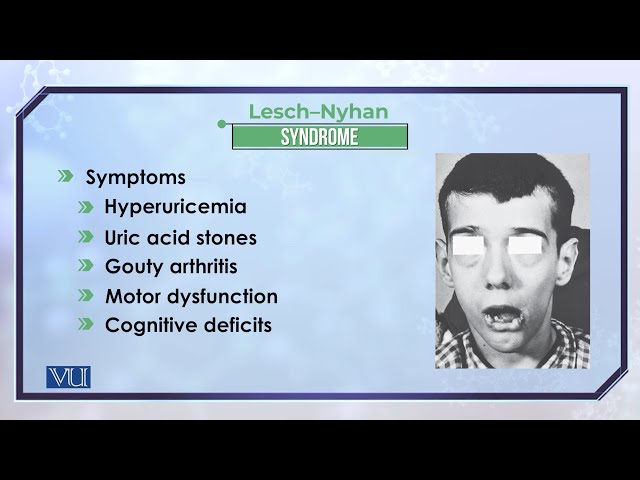 Disorders of Purine Metabolism | Biochemistry II (Theory) | BIO506T_Topic169