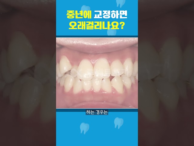 중년에 교정하면 오래 걸리나요?!😣나이도 있고 교정이 오래 걸릴까 봐 걱정되네요 | #shorts #나이 #치아교정