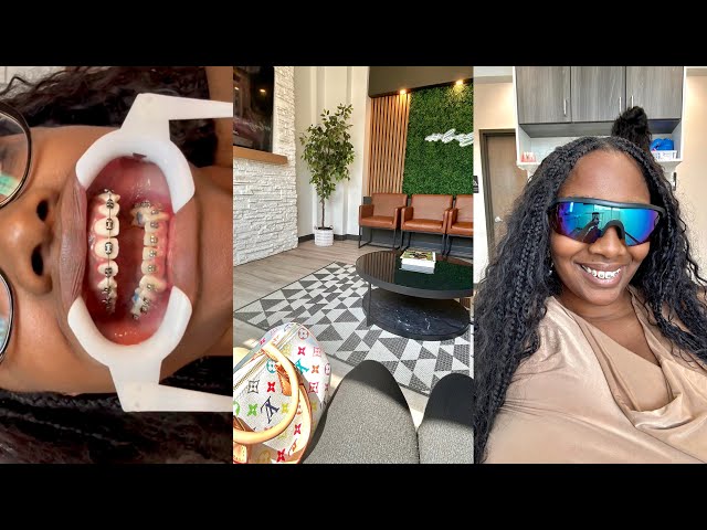 Adult Braces Journey: Gingivitis Scare 😳 Deep Gum Cleaning at Dentist & Orthodontist Visit