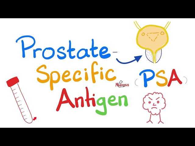 Prostate Cancer Screening - Prostate Specific Antigen (PSA) Test - Large Prostate - Lab results