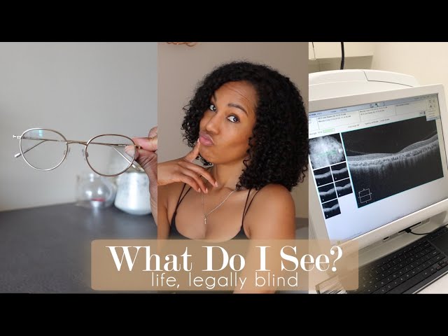 HOW DO LEGALLY BLIND PEOPLE SEE |What Do I See? | What is Stargardt's Disease